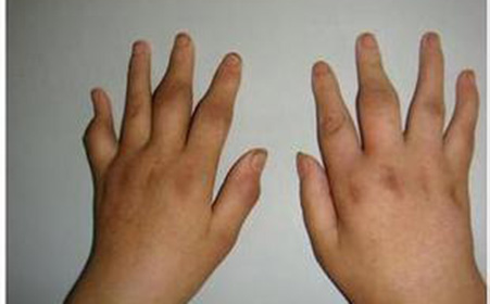 北京万岁中医院_灵气治病_美容减肥长寿_高血压高血脂高血糖_脑梗脑溢血_近视肥胖痴呆_头疼失眠_病毒肝炎_病毒感冒_肿瘤癌症