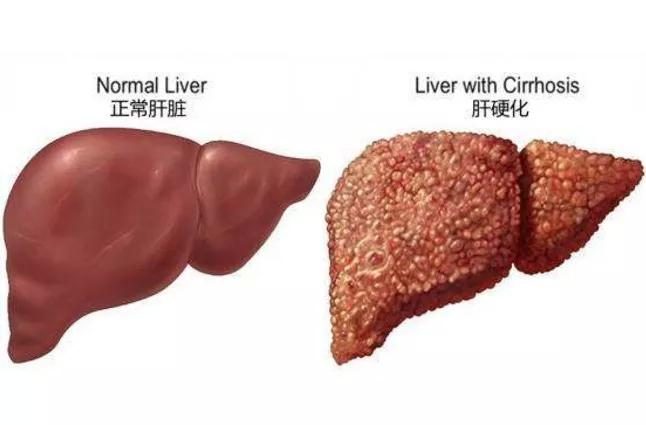 北京万岁中医院_灵气治病_美容减肥长寿_高血压高血脂高血糖_脑梗脑溢血_近视肥胖痴呆_头疼失眠_病毒肝炎_病毒感冒_肿瘤癌症