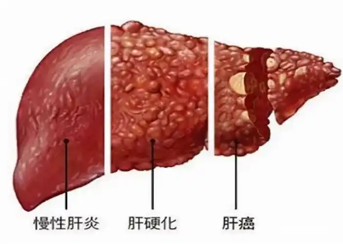 北京万岁医院_灵气治病_美容减肥长寿_高血压高血脂高血糖_脑梗脑溢血_近视肥胖痴呆_头疼失眠_病毒肝炎_病毒感冒_肿瘤癌症